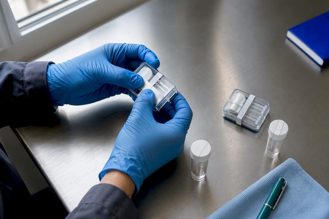 Mold samples prepared for laboratory analysis